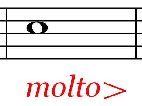 Molto Music Definition: An Eclectic Exploration of Musical Boundaries